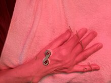 ミエリア美容鍼灸院(mielia美容鍼灸院)/関節リウマチや手の痛みの施術