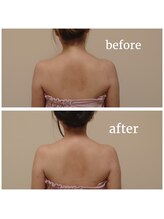 ココプレジール(Cocoplaisir)/巻き肩/猫背/肩甲骨周り