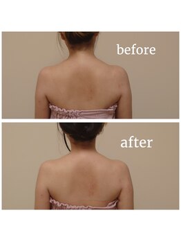 ココプレジール(Cocoplaisir)/巻き肩/猫背/肩甲骨周り