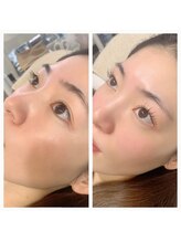 ミセレルオカザキ(MISEREL OKAZAKI)/