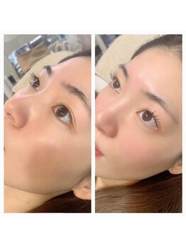 ミセレルオカザキ(MISEREL OKAZAKI)/