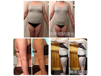 ヨサパーク アカーシャ(YOSA PARK AKASHA)