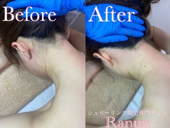 ラナン(Ranun)/下着の履き心地がとっても快適に