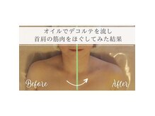 クレイン アキシマ(crane akishima)の雰囲気（肩の盛上がりが取れるとサイズダウンしたように見えます。）