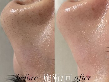 リスポアラボ(LIS PORE.LAB)/