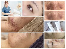 ビラ ベルダ(Bira Beldad)