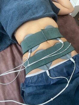 シュシュ(chouchou)/EMS