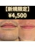 【新規限定★人気NO.1】ヒゲ脱毛+クールダウン保湿パック無料 ¥9,000→¥4,500