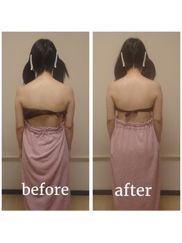 ココプレジール(Cocoplaisir)/巻き肩/猫背/肩甲骨周り