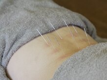 はり処堂 弥勒