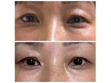 オリーブ(Olive)の雰囲気（目元のお悩みご相談ください♪眼精疲労、下垂、クマ、たるみケア）