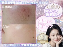 リトルーム(Litroom: from Seoul)/TROIPEEL