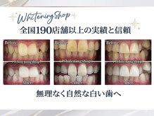 ホワイトニングショップ 津店の雰囲気（清潔感UP！長年の着色悩みにも。矯正中の方も大歓迎◎）