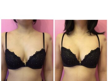 ドリームバスト 南森町(Dream Bust)の写真/初めての方も安心◎バストケアで憧れのふわふわマシュマロバストを目指しませんか？