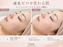 リアン(Lien)の雰囲気(サロン一押し☆ダブル脱毛☆光脱毛とワックスの併用で効果抜群◎)