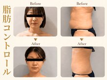 ツキ(TUKI+)の雰囲気（美容外科は避けたい方へ。切らずに叶える脂肪コントロール◎）