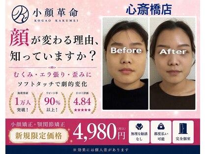 小顔革命 心斎橋の写真