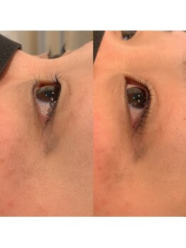 ベリー 静岡駅前店(Very)/まつ毛パーマ 