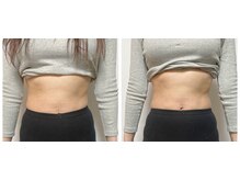 ザ ボディメイク(THE BODY MAKE)/【痩身】お腹+美尻+小顔+バスト