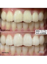 ビーバイビー(BBYB)/初回トライアルのお客様実例♪