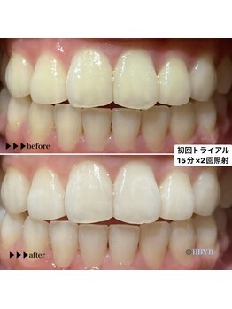 ビーバイビー(BBYB)/初回トライアルのお客様実例♪