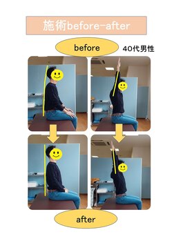 いみすぽ整体/40代男性ビフォアアフター
