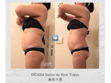 インディバホリトウキョウ(INDIBA HORI TOKYO)の雰囲気（インディバは年齢問わず健康と美容の土台作りには欠かせません）
