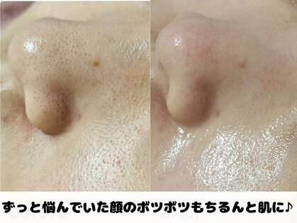 リノリノ(LinoLino)の写真
