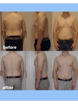 ホロニック ベルサンテ(Holonic Belle Sante)/メディセルハイブリッド