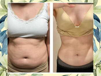 ヨサパーク ハーブ ラキ 鳴海店(YOSA PARK herb *Laki)/大人女性のためのダイエット