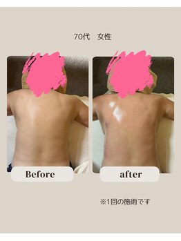 アロナ(ARONA)/ハンドセラピスでむくみスッキリ