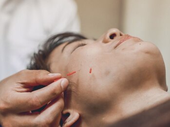 鍼灸からだケア 元住吉 ［肩凝り・腰痛改善/もみほぐし・ストレッチ・リンパ・整体］/