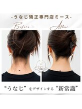 ミース 長野店/うなじ矯正◆ビフォーアフター