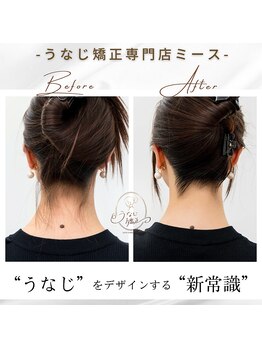 ミース 長野店/うなじ矯正◆ビフォーアフター