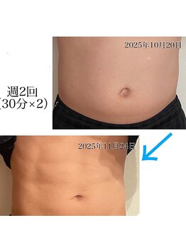 デジール/痩身×EMS7倍!筋肉増×脂肪減