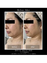 パルファンドゥー(parfum doux)/【エイジング】ビフォーアフター