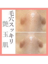 トータルビューティーサロン ヴィヴィエ(ViVier)/スッキリ毛穴ケア