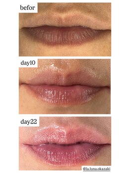 ラ ルーナ ル ソレイユ(La.luna Le.soleil)/ローマピンク