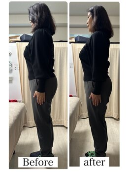 エリシオン(ELYSION)/痩身