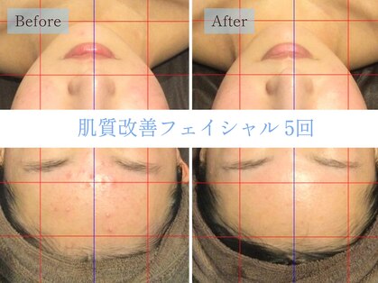 リテルナ(Re.terna)の写真