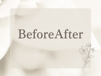 シーファイブメットビューティ 西11丁目店(C5medビューティ)/ビフォーアフター