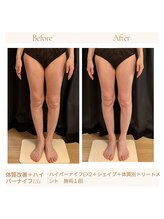 パチュプチ(Patchou petit)/Before→after