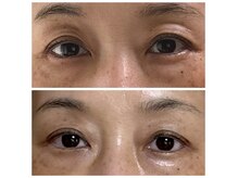 オリーブ(Olive)の雰囲気（瞼のたるみ、くすみもスッキリ☆目元専門エステ）