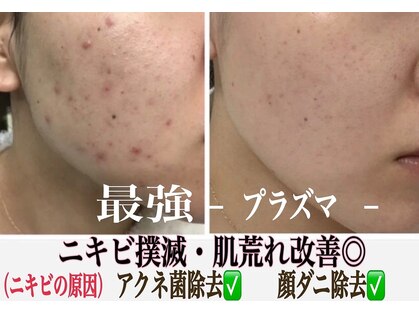 美的アヴェニール(美的.Avenir)の写真