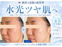 ユアーズ ビューティー(YOURS beauty)/ハイアールチューン