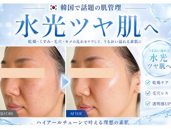 ユアーズ ビューティー(YOURS beauty)/ハイアールチューン