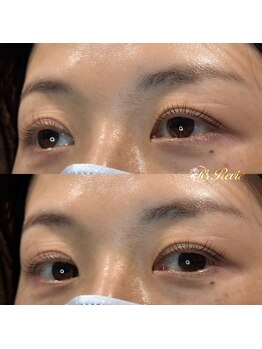 レビー(Revie)/セラムラッシュリフト