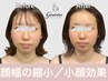 【超お得】頭蓋骨矯正から入る独自メソッドの小顔矯正！頭のサイズダウンも◎
