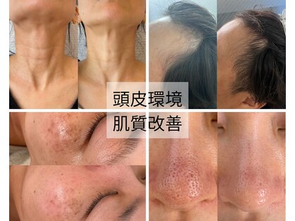 アオラ(Aola)の写真