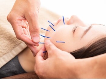 ハリッシュの写真/結果重視の方へ★美容鍼指導者が行う施術×スキンケア指導で、自分史上最高のお肌&ワンランク上の結果を。